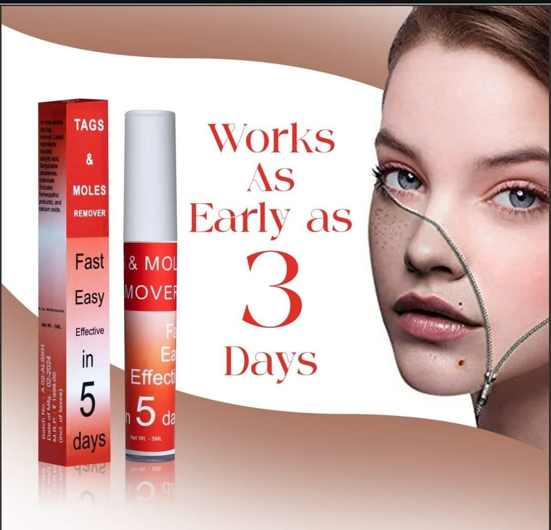 Professional Skin Tag & Mole Removal Device – Flawless Skin At Home - Housenvi